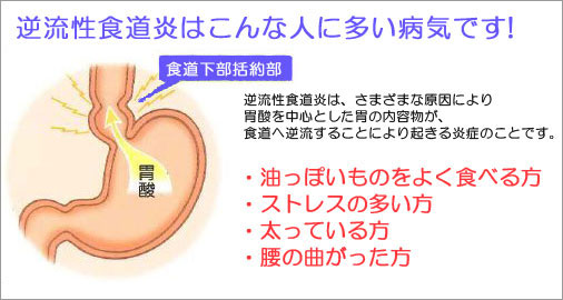 に 食後 なる 横