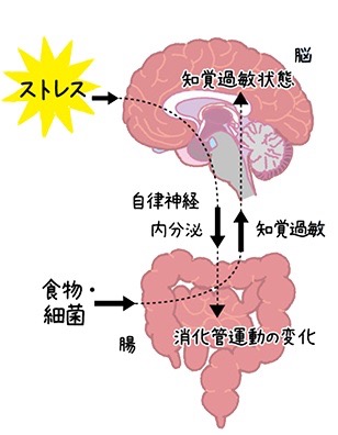 過敏性腸症候群(IBS)の原因